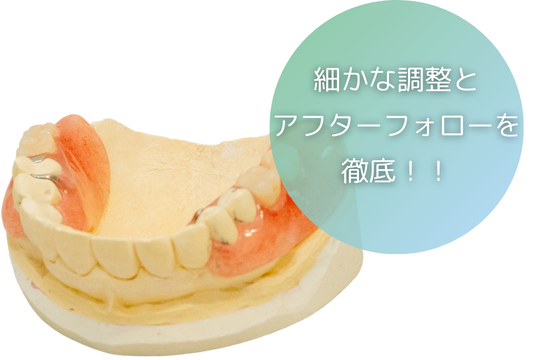入れ歯アフターフォロー